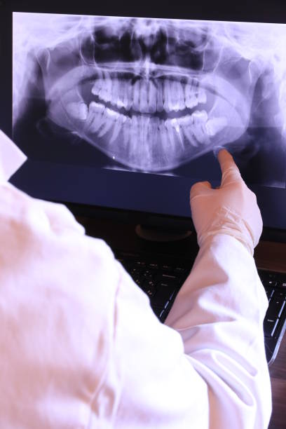 Best Emergency Tooth Extraction in Beaverton, MI