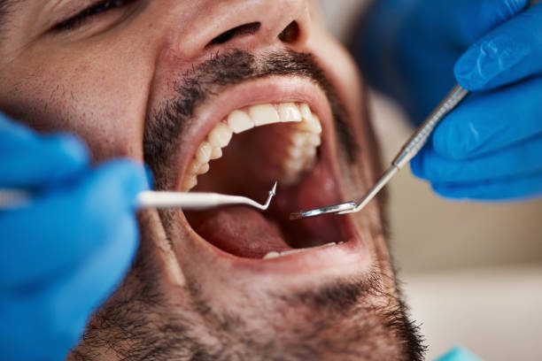 Best Emergency Dental Care for Trauma or Injury in Beaverton, MI